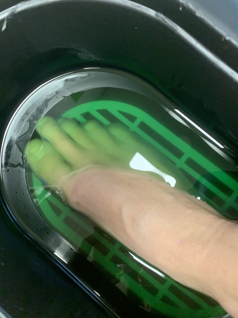 11 Abi Tervisekabinetis soe parafiini hooldus.Jalg on parafiini vannis rohelise vedela parafiini sees